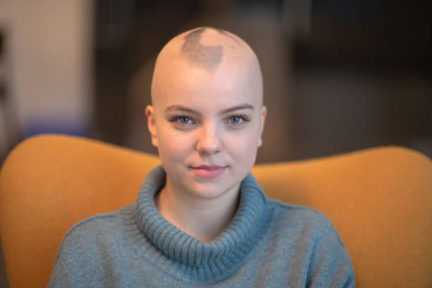 Alopecia: What It Is, What Are The Signs And How It Is Treated